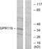 Glucose-dependent insulinotropic receptor antibody, LS-B6791, Lifespan Biosciences, Western Blot image 