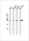 RAB5B, Member RAS Oncogene Family antibody, M06608, Boster Biological Technology, Western Blot image 
