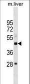 SET Domain Containing 4 antibody, LS-C158953, Lifespan Biosciences, Western Blot image 