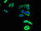 Discoidin Domain Receptor Tyrosine Kinase 2 antibody, CSB-PA620985LA01HU, Cusabio, Immunofluorescence image 