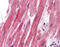 Snail Family Transcriptional Repressor 2 antibody, 27-822, ProSci, Immunohistochemistry paraffin image 