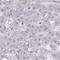 Nicotinamide Nucleotide Adenylyltransferase 1 antibody, NBP2-32464, Novus Biologicals, Immunohistochemistry frozen image 