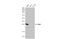 Steroidogenic Acute Regulatory Protein antibody, GTX636802, GeneTex, Western Blot image 