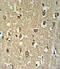 Cholinergic Receptor Nicotinic Alpha 3 Subunit antibody, abx032382, Abbexa, Immunohistochemistry paraffin image 