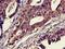 TTK Protein Kinase antibody, orb53067, Biorbyt, Immunohistochemistry frozen image 