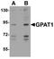 Glycerol-3-Phosphate Acyltransferase, Mitochondrial antibody, A05432, Boster Biological Technology, Western Blot image 