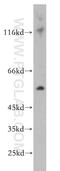 Phospholipase A2 Group IVF antibody, 21411-1-AP, Proteintech Group, Western Blot image 