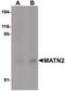 Matrilin 2 antibody, PA5-20734, Invitrogen Antibodies, Western Blot image 