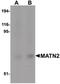 Matrilin 2 antibody, PA5-20734, Invitrogen Antibodies, Western Blot image 