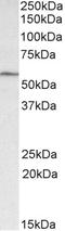 Glucagon-like peptide 1 receptor antibody, LS-B14777, Lifespan Biosciences, Western Blot image 