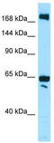 WNK Lysine Deficient Protein Kinase 2 antibody, TA338126, Origene, Western Blot image 