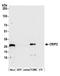 Cysteine Rich Protein 2 antibody, A305-612A-M, Bethyl Labs, Western Blot image 