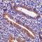 Hepatitis A Virus Cellular Receptor 1 antibody, orb74722, Biorbyt, Immunohistochemistry paraffin image 