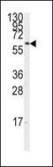 Cytochrome P450 Family 17 Subfamily A Member 1 antibody, PA5-15044, Invitrogen Antibodies, Western Blot image 