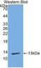 Polymeric Immunoglobulin Receptor antibody, LS-C374076, Lifespan Biosciences, Western Blot image 