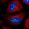 UTP3 Small Subunit Processome Component antibody, PA5-57354, Invitrogen Antibodies, Immunofluorescence image 