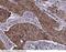 TNF Alpha Induced Protein 8 antibody, 14559-T60, Sino Biological, Immunohistochemistry paraffin image 