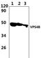 Vacuolar Protein Sorting 4 Homolog B antibody, PA5-75945, Invitrogen Antibodies, Western Blot image 