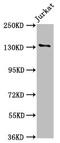 NPHS1 Adhesion Molecule, Nephrin antibody, LS-C370062, Lifespan Biosciences, Western Blot image 