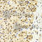 Protein Phosphatase 1 Regulatory Subunit 8 antibody, A6701, ABclonal Technology, Immunohistochemistry paraffin image 