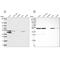 IKBKB Interacting Protein antibody, NBP2-56525, Novus Biologicals, Western Blot image 