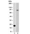 Cadherin 1 antibody, 34-050, ProSci, Western Blot image 