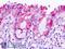 Galectin 3 antibody, LS-B9435, Lifespan Biosciences, Immunohistochemistry frozen image 