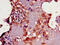 CD33 Molecule antibody, CSB-PA004925LA01HU, Cusabio, Immunohistochemistry paraffin image 