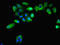 Peroxiredoxin 1 antibody, LS-C211021, Lifespan Biosciences, Immunofluorescence image 