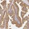 Alpha-2-Glycoprotein 1, Zinc-Binding antibody, NBP1-86842, Novus Biologicals, Immunohistochemistry frozen image 