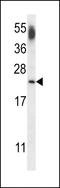 Cannabinoid Receptor Interacting Protein 1 antibody, LS-C168895, Lifespan Biosciences, Western Blot image 