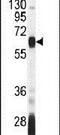 Autoimmune regulator antibody, PA5-24554, Invitrogen Antibodies, Western Blot image 