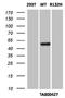 Isocitrate Dehydrogenase (NADP(+)) 1, Cytosolic antibody, LS-C336971, Lifespan Biosciences, Western Blot image 