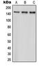 Par-3 Family Cell Polarity Regulator antibody, MBS821342, MyBioSource, Western Blot image 