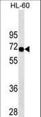 Switching B Cell Complex Subunit SWAP70 antibody, LS-C157116, Lifespan Biosciences, Western Blot image 