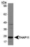 THAP Domain Containing 11 antibody, NBP1-49463, Novus Biologicals, Western Blot image 