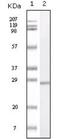 S100 Calcium Binding Protein A1 antibody, NB110-60530, Novus Biologicals, Western Blot image 