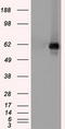 Checkpoint Kinase 2 antibody, TA500390S, Origene, Western Blot image 
