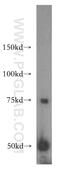 Bile Acid-CoA:Amino Acid N-Acyltransferase antibody, 15990-1-AP, Proteintech Group, Western Blot image 
