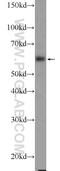 Trichoplein Keratin Filament Binding antibody, 25931-1-AP, Proteintech Group, Western Blot image 