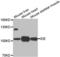 Insulin Degrading Enzyme antibody, LS-C331595, Lifespan Biosciences, Western Blot image 