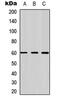 Frizzled Class Receptor 4 antibody, abx121606, Abbexa, Western Blot image 