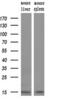 NADH:Ubiquinone Oxidoreductase Subunit A5 antibody, M09003, Boster Biological Technology, Western Blot image 