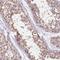 UBX Domain Protein 6 antibody, HPA040906, Atlas Antibodies, Immunohistochemistry frozen image 