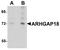 Rho GTPase-activating protein 18 antibody, A08418-1, Boster Biological Technology, Western Blot image 