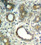 Protein Tyrosine Phosphatase Non-Receptor Type 11 antibody, LS-C336071, Lifespan Biosciences, Immunohistochemistry paraffin image 