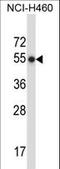 Matrix Metallopeptidase 8 antibody, LS-C164248, Lifespan Biosciences, Western Blot image 