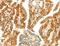 Alanyl-TRNA Synthetase 2, Mitochondrial antibody, LS-C403800, Lifespan Biosciences, Immunohistochemistry paraffin image 