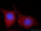 TIMP Metallopeptidase Inhibitor 4 antibody, 12326-1-AP, Proteintech Group, Immunofluorescence image 