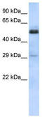 Scm Polycomb Group Protein Like 1 antibody, TA339137, Origene, Western Blot image 
